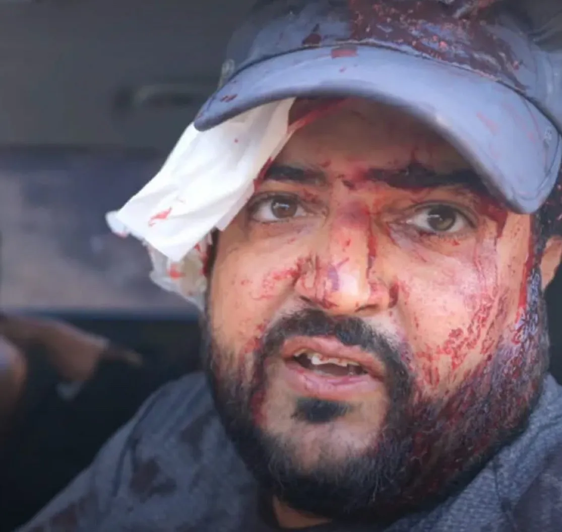 Colonos israelíes atacan a palestinos y golpean a una periodista de EE. UU. en Cisjordania